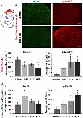 The Expression of Transcription Factors Mecp2 and CREB Is Modulated in Inflammatory Pelvic Pain